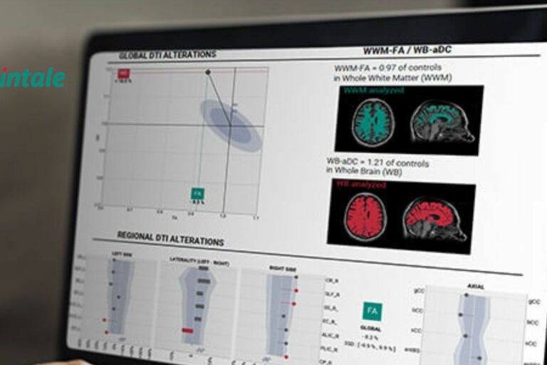 Angels Santé soutient Braintale Angels Santé soutient Braintale