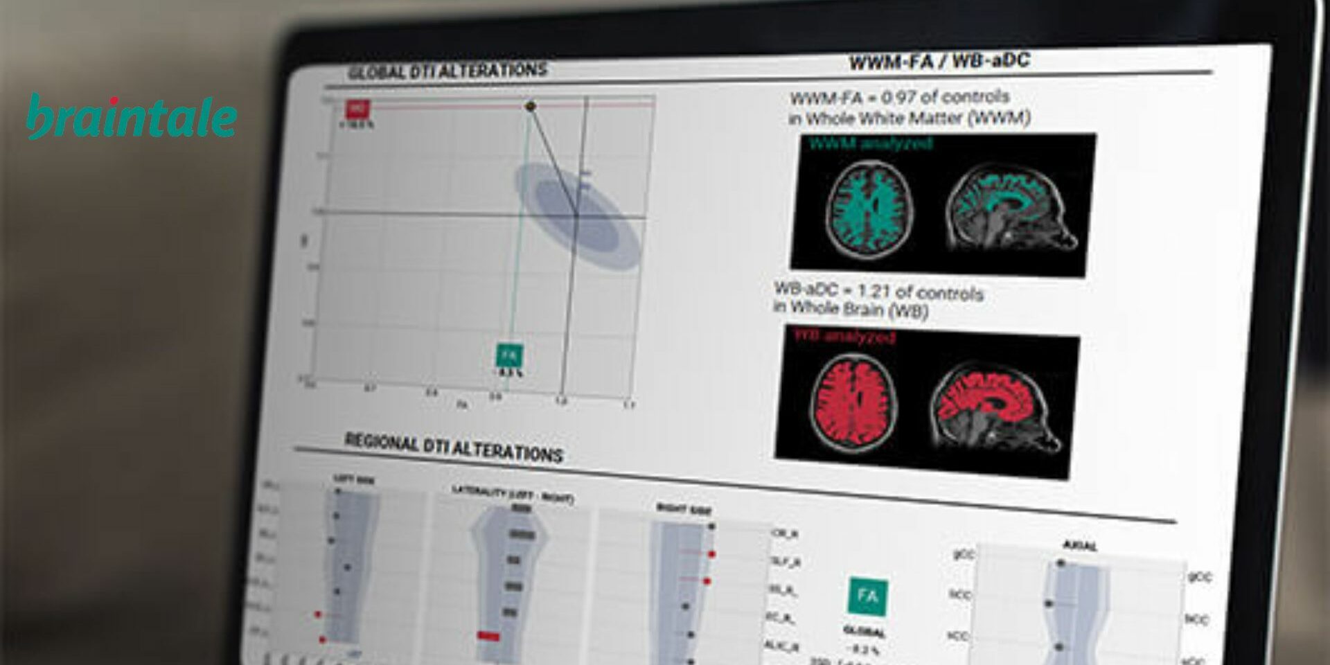 Angels Santé soutient Braintale