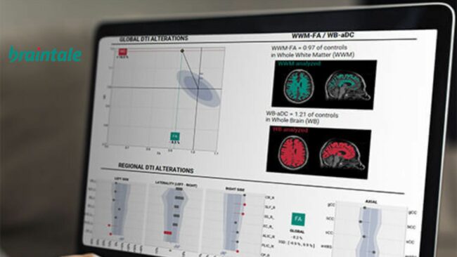 Angels Santé soutient Braintale